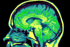 brain-scan-2-pw06iyvOzAjtVVkeEIi4cw